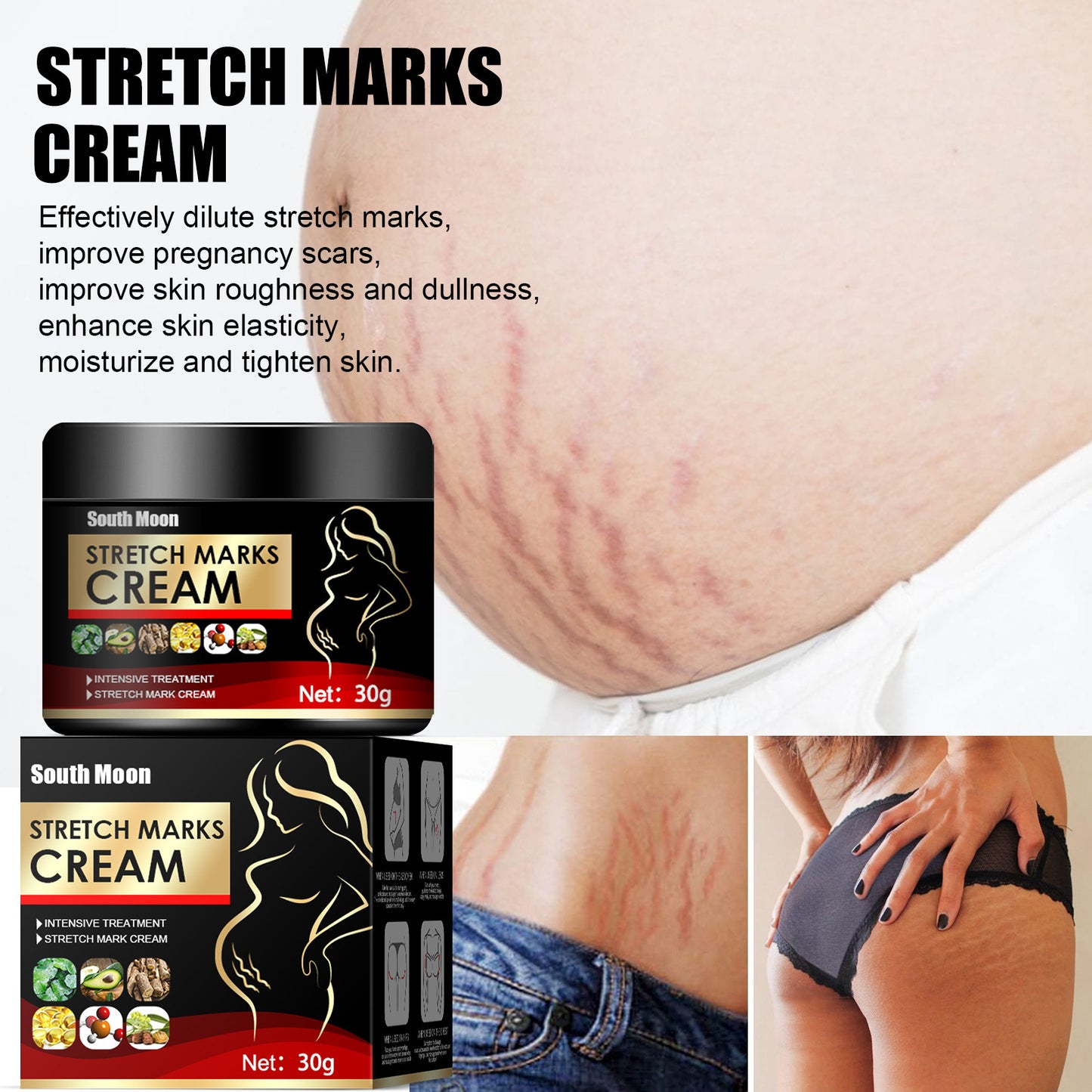 Obesity Stretch Mark Growth Orange Peel Repair Cream
