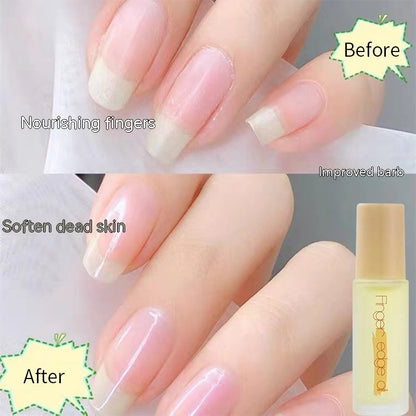 Nail Base Coat Nutrient Solution Anti-agnail