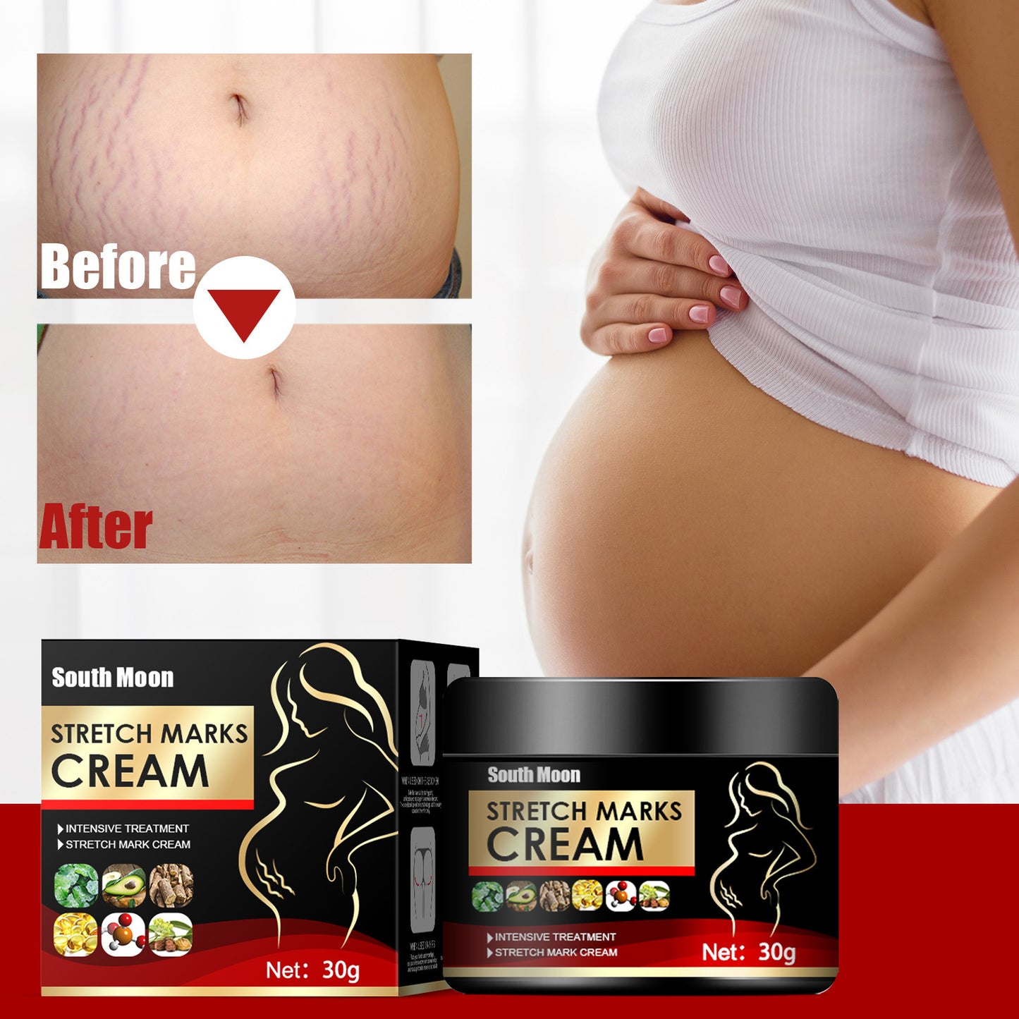 Obesity Stretch Mark Growth Orange Peel Repair Cream