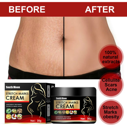Obesity Stretch Mark Growth Orange Peel Repair Cream