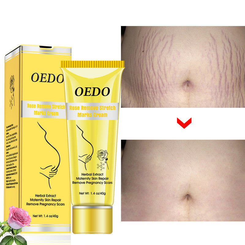 Rose Stretch Mark Removal Cream Anti-Wrinkle