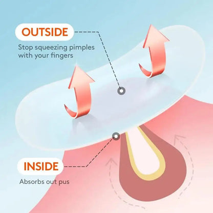 Acne Patch 36 Counts Acne Patches For Covering Zits And Blemishes, Spot Stickers Tea Tree Essential Oil Pimple Patches For Face