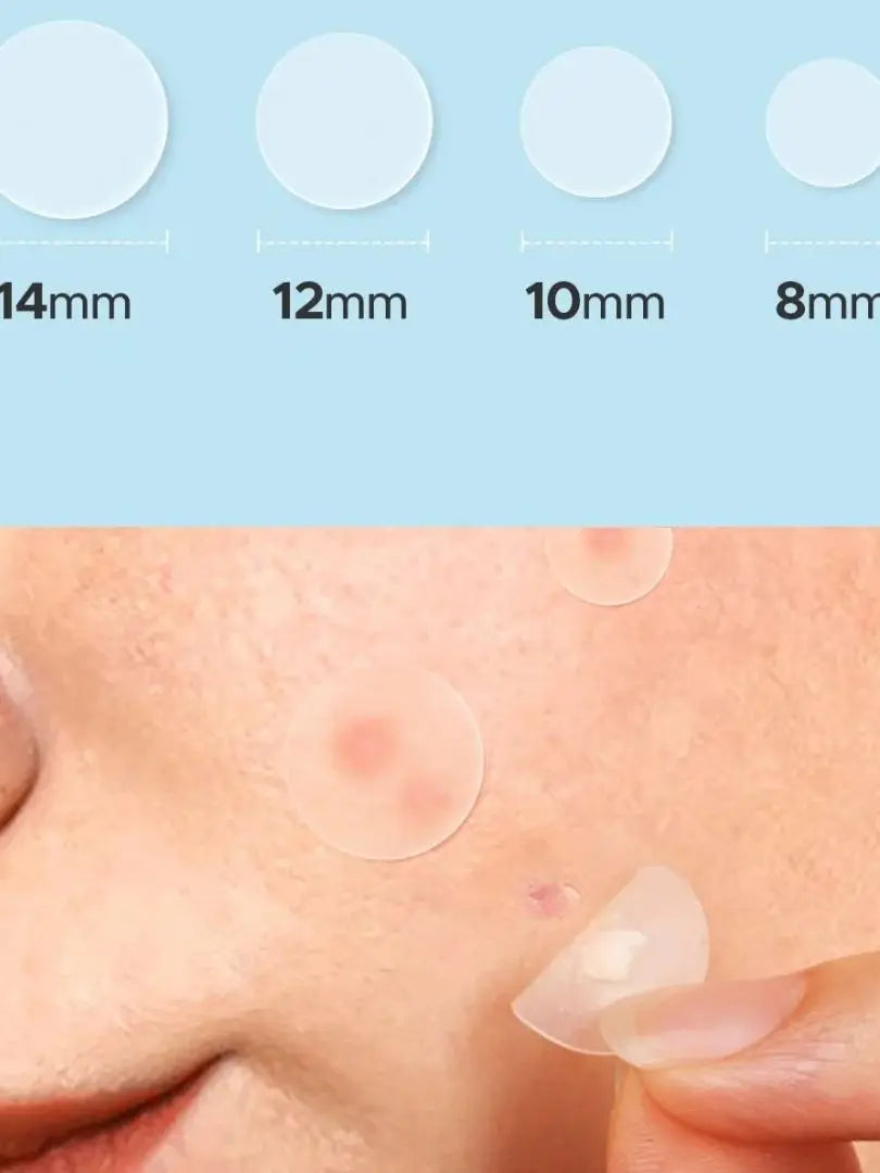 Pimple Patches 360pcs Transparent Round Hydrocolloid Acne Patches, Gentle & Invisible, Day & Night Use, For All Skin Types