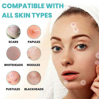 Acne Patch 36 Counts Acne Patches For Covering Zits And Blemishes, Spot Stickers Tea Tree Essential Oil Pimple Patches For Face
