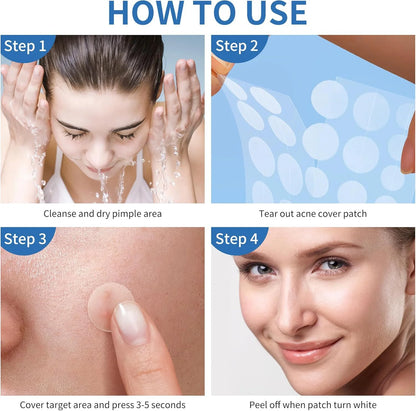 Pimple Patches 360pcs Transparent Round Hydrocolloid Acne Patches, Gentle & Invisible, Day & Night Use, For All Skin Types