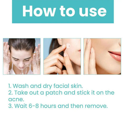 Acne Patch 36 Counts Acne Patches For Covering Zits And Blemishes, Spot Stickers Tea Tree Essential Oil Pimple Patches For Face