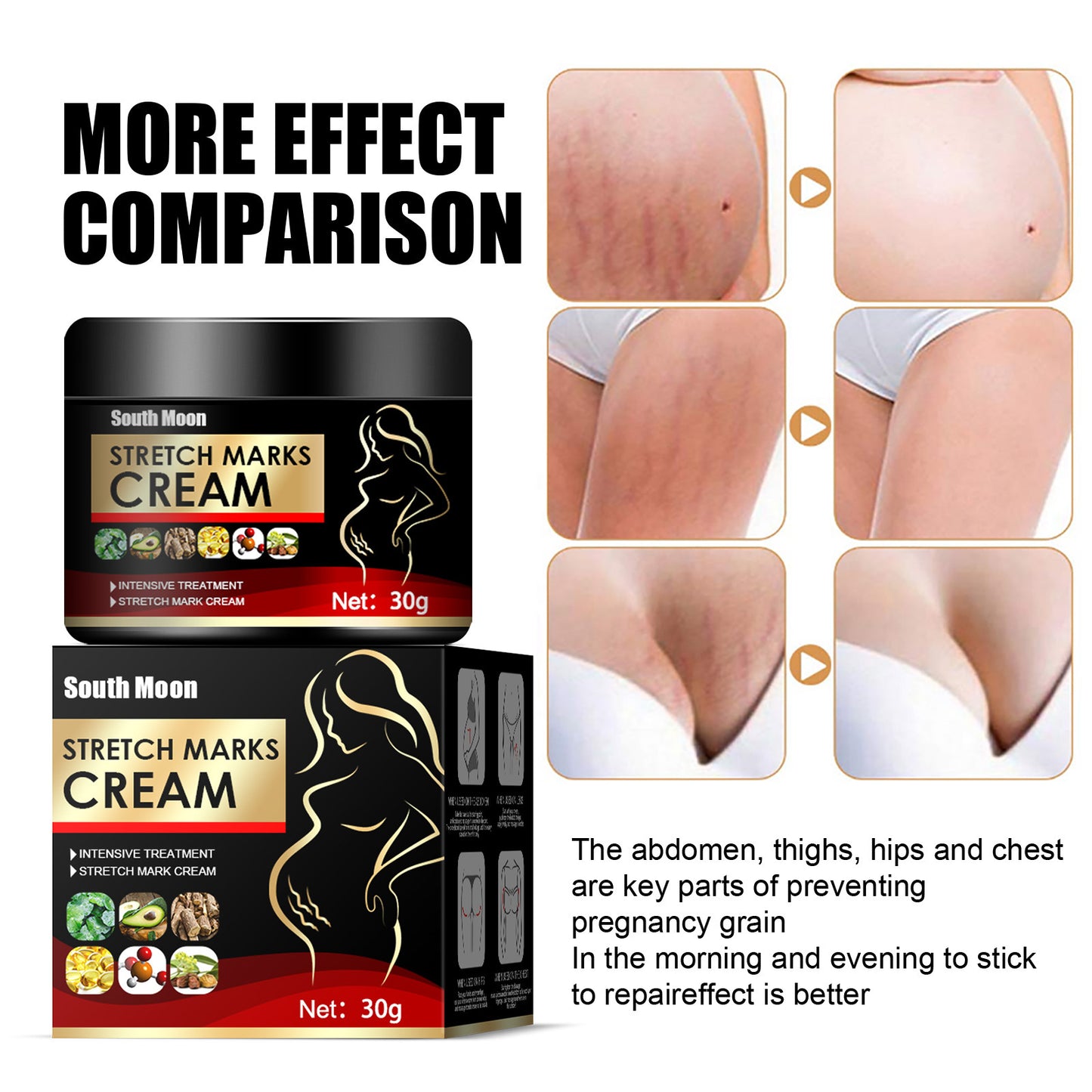 Obesity Stretch Mark Growth Orange Peel Repair Cream